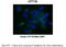 Carnitine Palmitoyltransferase 1B antibody, ARP46444_P050, Aviva Systems Biology, Immunohistochemistry frozen image 