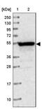 Protein Phosphatase 2 Regulatory Subunit B''Gamma antibody, PA5-59317, Invitrogen Antibodies, Western Blot image 