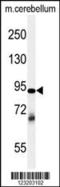 Ubiquitin thioesterase ZRANB1 antibody, 64-136, ProSci, Western Blot image 