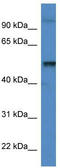 Katanin p60 ATPase-containing subunit A1 antibody, TA340148, Origene, Western Blot image 