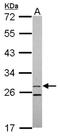 15-Hydroxyprostaglandin Dehydrogenase antibody, NBP2-21588, Novus Biologicals, Western Blot image 