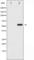 Cell Division Cycle 25B antibody, abx010539, Abbexa, Western Blot image 