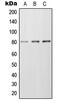 Frizzled Class Receptor 6 antibody, MBS821941, MyBioSource, Western Blot image 