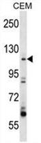 Rho Guanine Nucleotide Exchange Factor 1 antibody, AP50237PU-N, Origene, Western Blot image 