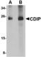Cell Death Inducing P53 Target 1 antibody, A10988, Boster Biological Technology, Western Blot image 