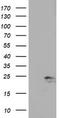 Ubiquitin Conjugating Enzyme E2 E3 antibody, TA504655, Origene, Western Blot image 