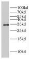 Family With Sequence Similarity 78 Member A antibody, FNab02996, FineTest, Western Blot image 