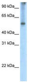 Eukaryotic Translation Initiation Factor 2A antibody, TA343946, Origene, Western Blot image 