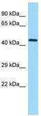 Ubiquitin Conjugating Enzyme E2 Q2 antibody, TA337794, Origene, Western Blot image 