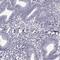 Leucine Rich Repeat Containing 27 antibody, NBP2-62655, Novus Biologicals, Immunohistochemistry paraffin image 