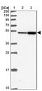 F-Box And Leucine Rich Repeat Protein 20 antibody, PA5-62180, Invitrogen Antibodies, Western Blot image 