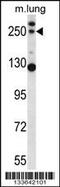 Complement Component 4B (Chido Blood Group), Copy 2 antibody, MBS9208858, MyBioSource, Western Blot image 