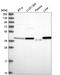 Phosphoserine aminotransferase antibody, HPA042924, Atlas Antibodies, Western Blot image 