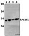 Ribosomal Protein S4 Y-Linked 1 antibody, PA5-75384, Invitrogen Antibodies, Western Blot image 