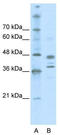 SWI/SNF-related matrix-associated actin-dependent regulator of chromatin subfamily B member 1 antibody, TA334778, Origene, Western Blot image 