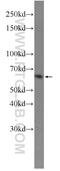 PKG1 antibody, 21646-1-AP, Proteintech Group, Western Blot image 