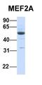 Mitochondrial Ribosomal Protein S18C antibody, orb382547, Biorbyt, Western Blot image 