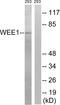 WEE1 G2 Checkpoint Kinase antibody, LS-C118328, Lifespan Biosciences, Western Blot image 