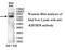 Kelch Repeat And BTB Domain Containing 8 antibody, MBS416759, MyBioSource, Western Blot image 