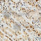 PD-L1 antibody, A1645, ABclonal Technology, Immunohistochemistry paraffin image 