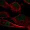 Chromosome 10 Open Reading Frame 55 antibody, NBP1-91710, Novus Biologicals, Immunofluorescence image 