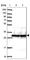 Small Nuclear Ribonucleoprotein Polypeptide A antibody, HPA046440, Atlas Antibodies, Western Blot image 