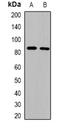 Zinc Finger Protein 541 antibody, orb382527, Biorbyt, Western Blot image 