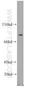 Denticleless protein homolog antibody, 12896-1-AP, Proteintech Group, Western Blot image 