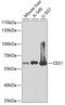 CES2 antibody, GTX53943, GeneTex, Western Blot image 