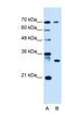 ATPase H+ Transporting Accessory Protein 1 Like antibody, NBP1-91585, Novus Biologicals, Western Blot image 