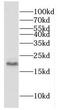Cofilin 2 antibody, FNab01827, FineTest, Western Blot image 