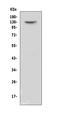 Voltage-dependent calcium channel subunit alpha-2/delta-2 antibody, A01560-1, Boster Biological Technology, Western Blot image 