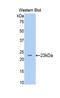 Beta-Secretase 1 antibody, LS-C292996, Lifespan Biosciences, Western Blot image 