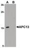 Anaphase Promoting Complex Subunit 13 antibody, PA5-20956, Invitrogen Antibodies, Western Blot image 
