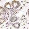 BRCA1 Associated Protein 1 antibody, A6533, ABclonal Technology, Immunohistochemistry paraffin image 