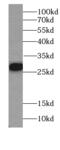 LOR antibody, FNab04822, FineTest, Western Blot image 