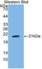 U1 small nuclear ribonucleoprotein C antibody, LS-C314768, Lifespan Biosciences, Western Blot image 