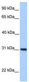 Helt BHLH Transcription Factor antibody, TA339650, Origene, Western Blot image 