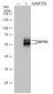 Zinc Finger Protein 703 antibody, GTX628896, GeneTex, Western Blot image 