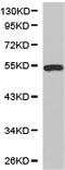 Fibrinogen Beta Chain antibody, TA324036, Origene, Western Blot image 