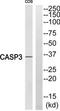 Caspase 3 antibody, TA312446, Origene, Western Blot image 