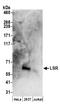Lipolysis-stimulated lipoprotein receptor antibody, A304-470A, Bethyl Labs, Western Blot image 