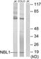 NBL1, DAN Family BMP Antagonist antibody, PA5-38608, Invitrogen Antibodies, Western Blot image 