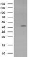 Potassium Voltage-Gated Channel Subfamily A Member Regulatory Beta Subunit 1 antibody, M06063, Boster Biological Technology, Western Blot image 