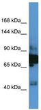 ELKS/Rab6-interacting/CAST family member 1 antibody, TA342631, Origene, Western Blot image 