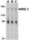 Insulin Receptor Substrate 1 antibody, TA306226, Origene, Western Blot image 