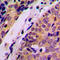 Histidyl-TRNA Synthetase antibody, LS-C353997, Lifespan Biosciences, Immunohistochemistry paraffin image 