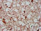 Protein AHNAK2 antibody, LS-C673042, Lifespan Biosciences, Immunohistochemistry paraffin image 
