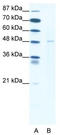 DEK Proto-Oncogene antibody, TA330034, Origene, Western Blot image 
