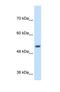 Signal Peptide Peptidase Like 2B antibody, NBP1-59510, Novus Biologicals, Western Blot image 